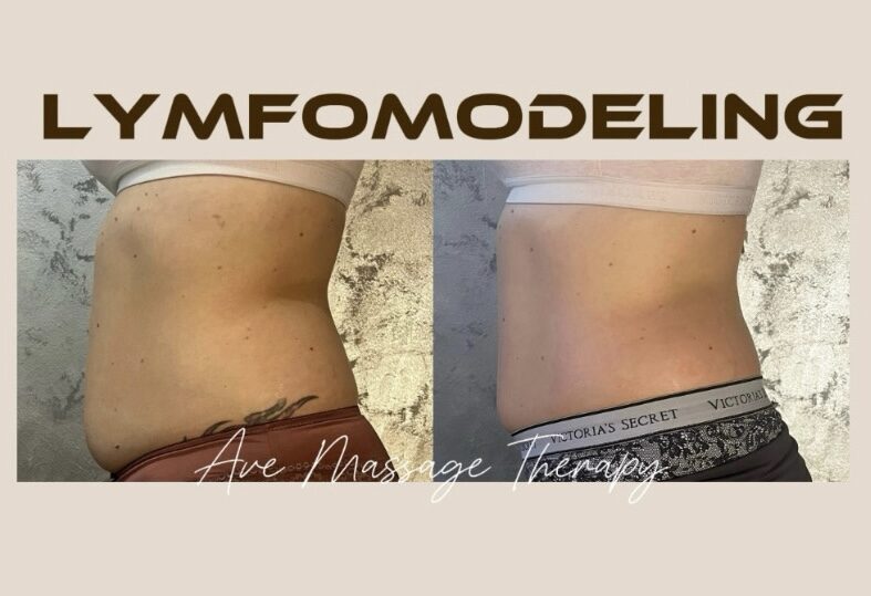 Lymfomodeling