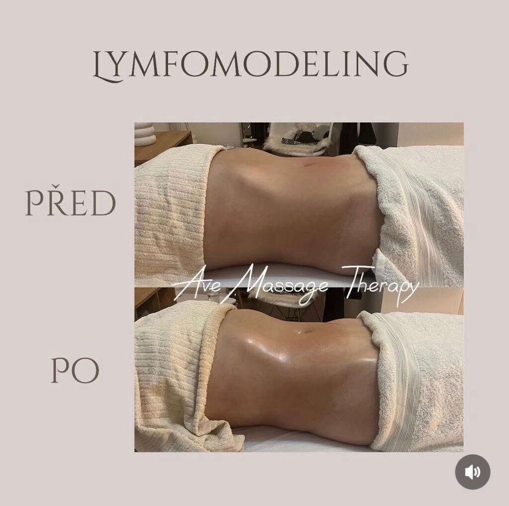 LYMFOMODELING BŘICHA PRAHA