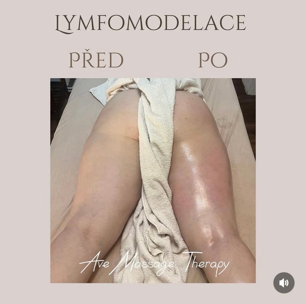 LYMFOMODELING NOHOUPRAHA