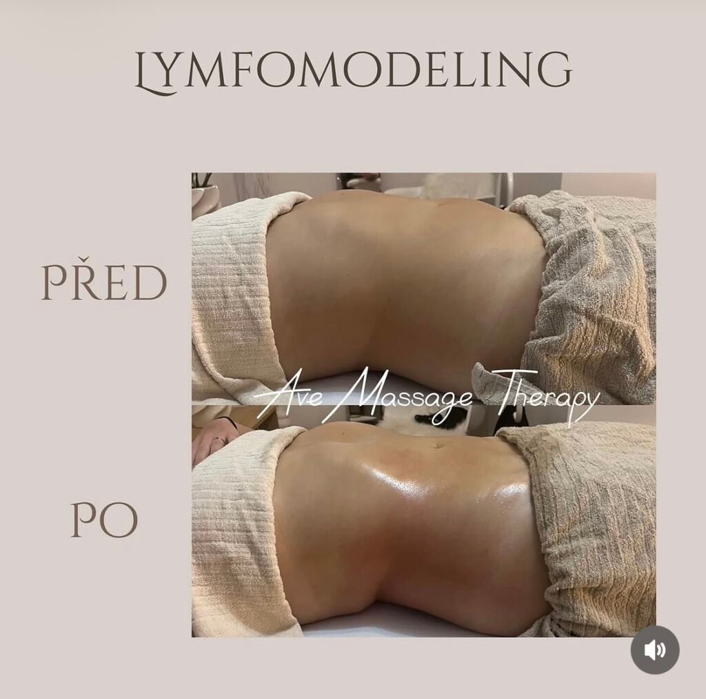 LYMFOMODELING BŘICHA PRAHA