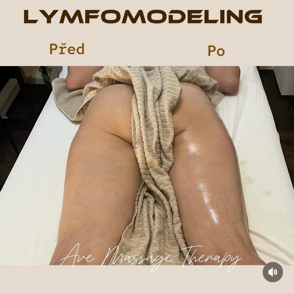 LYMFOMODELING NOHOU PRAHA